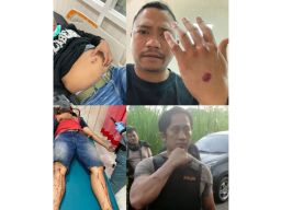 1 Polisi Korban Lemparan Bondet Jalani Operasi di RS Bhayangkara Surabaya