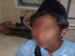 M. Syafik, korban pengeroyokan yang diduga dilakukan gerombolan orang tak dikenal di Desa Labuhan, Kecamatan Sreseh, Sampang. (Foto: Grup WhatsApp)