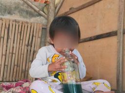 Viral, Bocah Empat Tahun di Sampang Kecanduan Hirup Aroma Bensin
