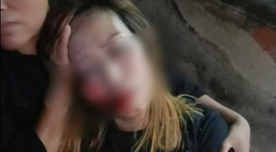 Wanita di Jember Babak Belur Dihajar Kenalan Facebook, Motor dan Perhiasan Raib