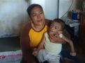 Balita di Kota Probolinggo yang butuh bantuan pengobatan digendong ibunya