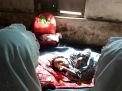 Lumpuh Sejak Lahir, Gadis di Banyuwangi ini Tak Tersentuh Pemerintah