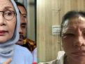 Ratna Sarumpaet Mengaku Berbohong Dianiaya, Ini Kata Tim Prabowo