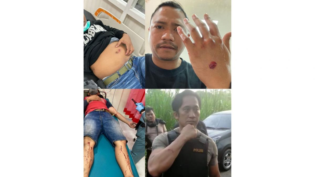 4 polisi terluka akibat diserang bom bondet di Pasuruan. (Foto: Polres Pasuruan/jatimnow.com)