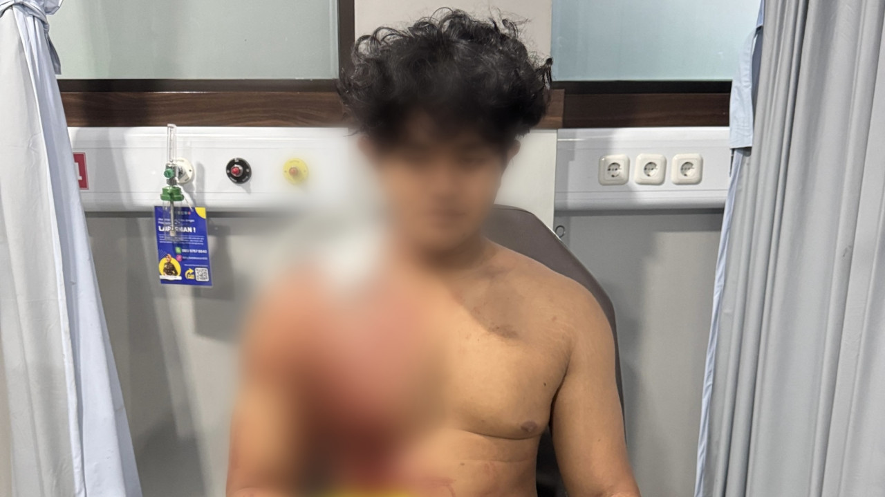 Korban pengeroyokan dan penikaman saat dirawat di RS Hasta Brata Kota Batu. (Foto: Polsek Batu Kota/jatimnow.com)