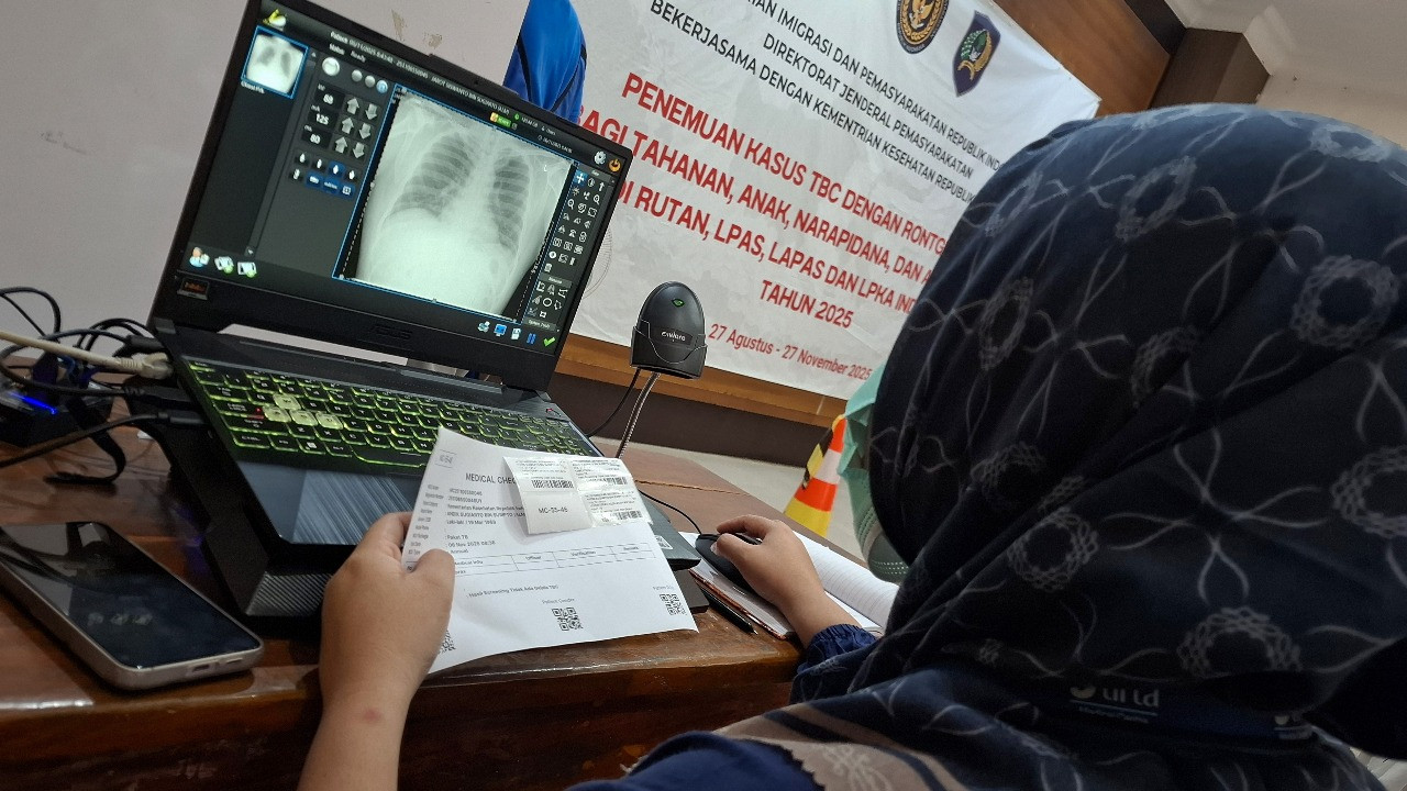 Skrining TBS di Lapas Kediri. (Foto: Lapas Kediri/jatimnow.com)