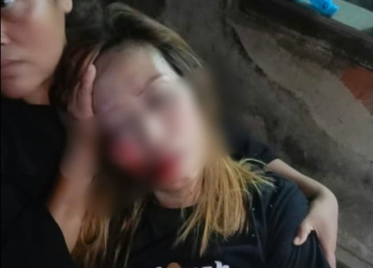 Sitti Sulaiha, seorang perempuan, ditemukan pingsan dengan kondisi babak belur di kawasan kebun pinus Dusun Panggung Pinang, Desa Plerean, Kecamatan Sumberjambe, Jember.