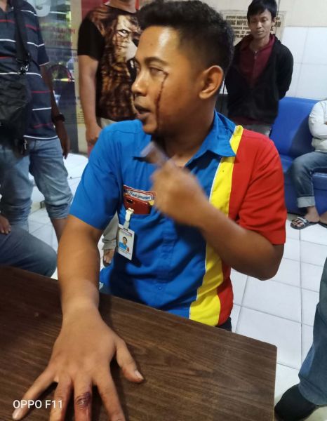 Pegawai minimarket di Surabaya yang ditembak perampok berpistol