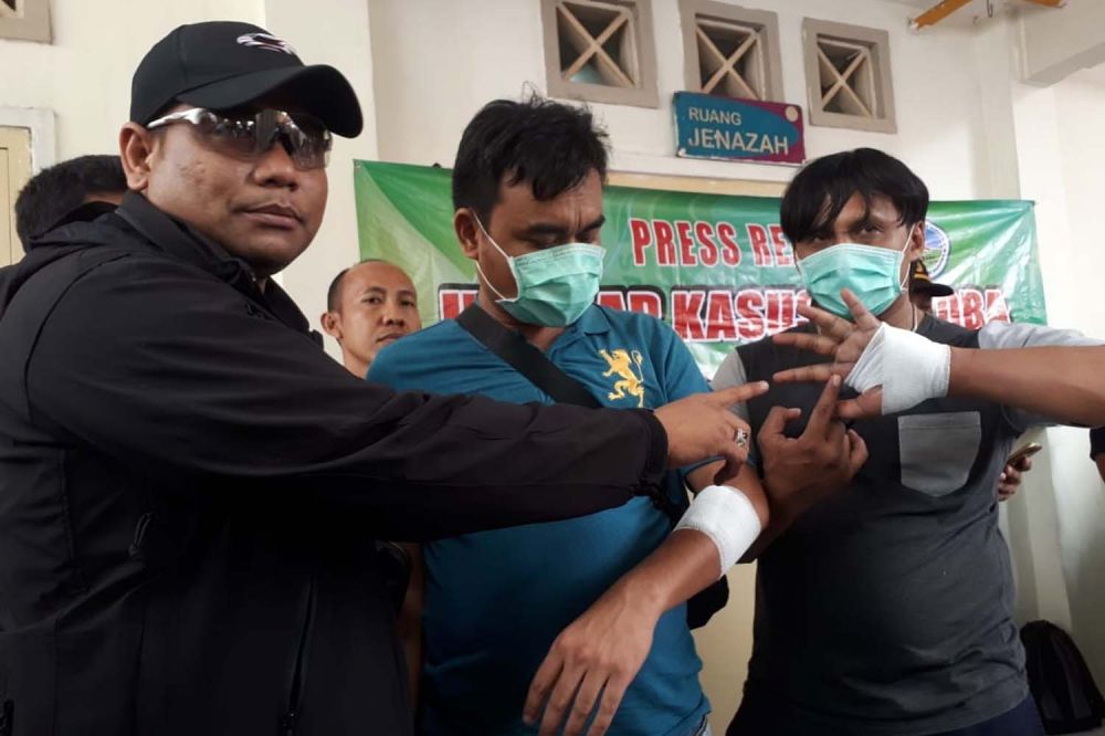 Kasatresnarkoba Polrestabes Surabaya AKBP Memo Ardian (kiri) menunjukkan luka bacok dua anggotanya akibat diserang kurir narkoba yang ditembak mati