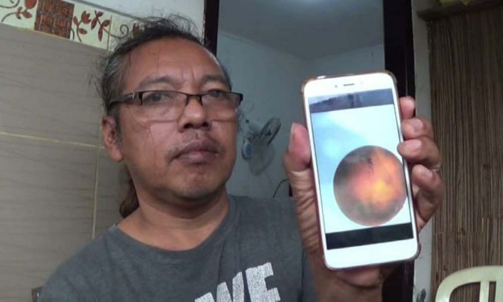 Nanang Suyono menunjukkan mata kirinya yang mendadak rabun