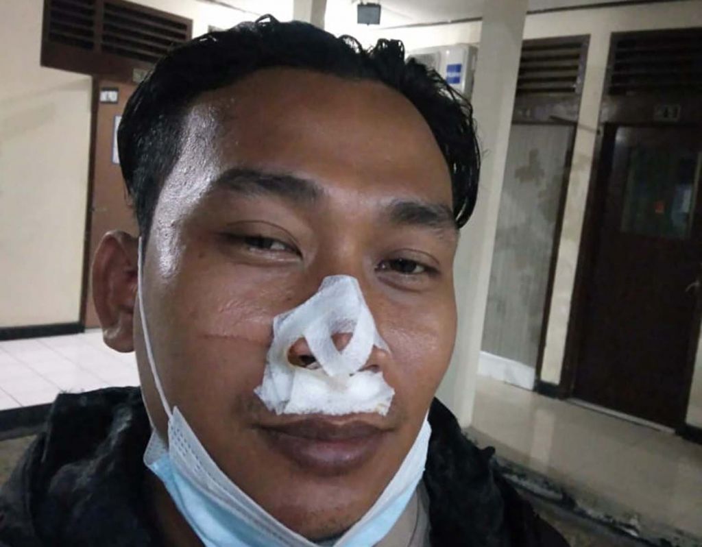 Brigadir Firman, salah satu anggota Unit Reskrim Polsek Sukolilo, Surabaya yang terluka akibat mengejar bandit bengis