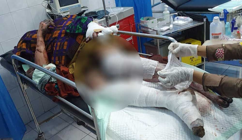 Korban ledakan mercon dirawat di RSU Wonolangan Dringu