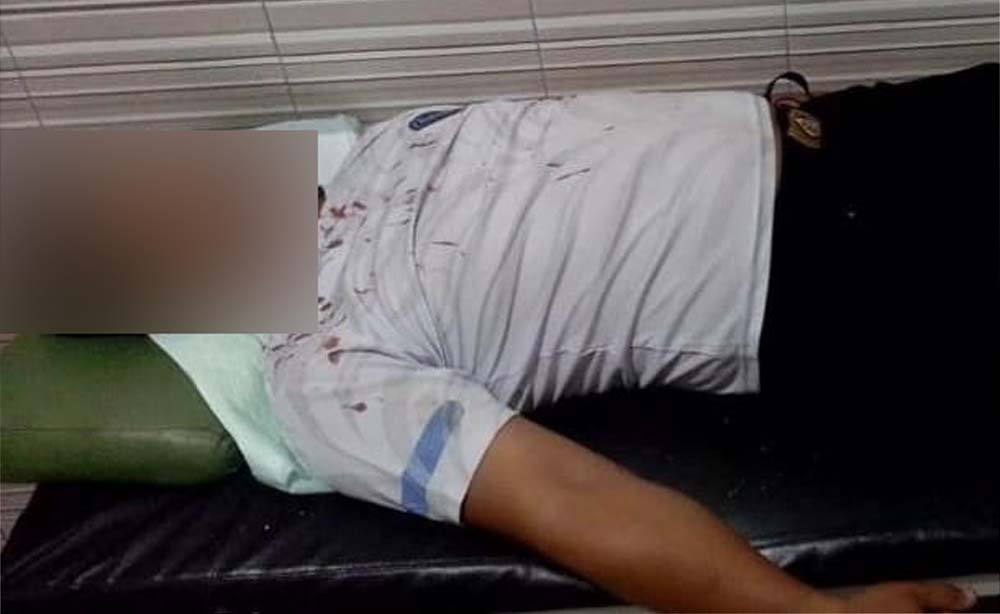 Bripka AA luka dibagian mata kanannya